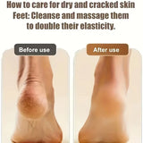 Electric Foot File Callus Remover Remover Rechargeable Pedicure Tool with 3 Grinding Heads for Dead Hard Cracked Dry Feet Skin