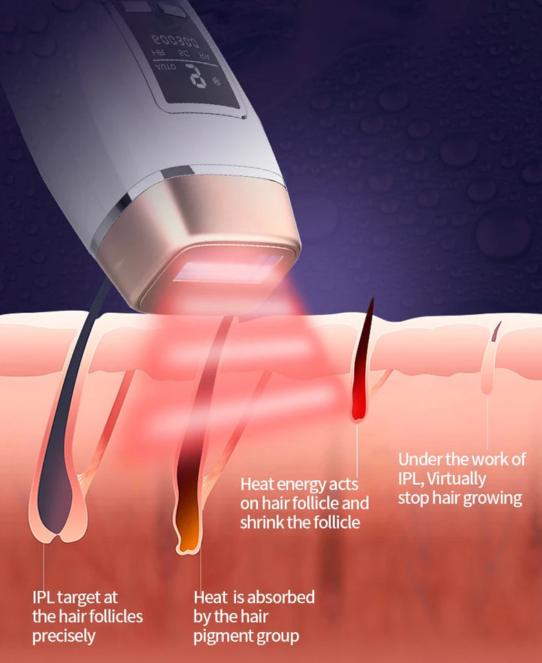 Newest 4in1 IPL Hair Removal Laser Epilator 999000 Flash Cooling LCD Acne Treatment Rejuvenation Device for Home Bikini Trimmer