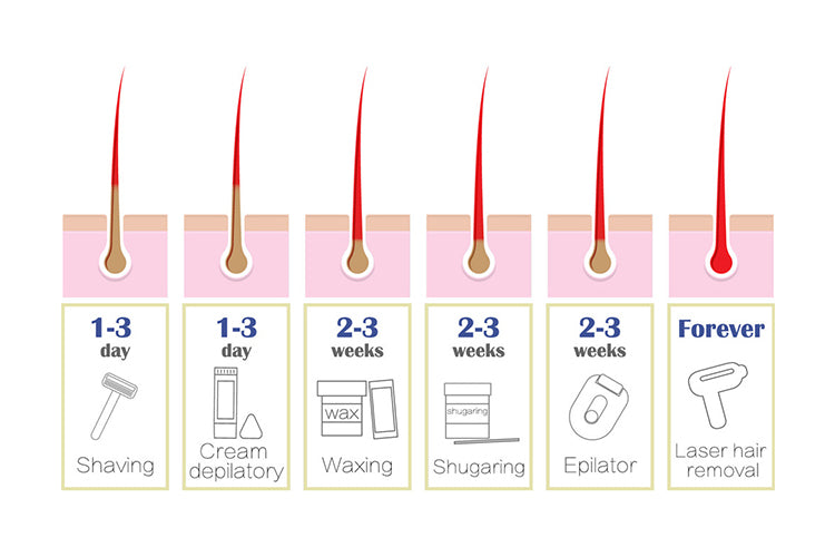 2025 Newest 808nm Diode ICE Platinum Diode Hair Removal Machine 755 808 1064nm hair remove hair