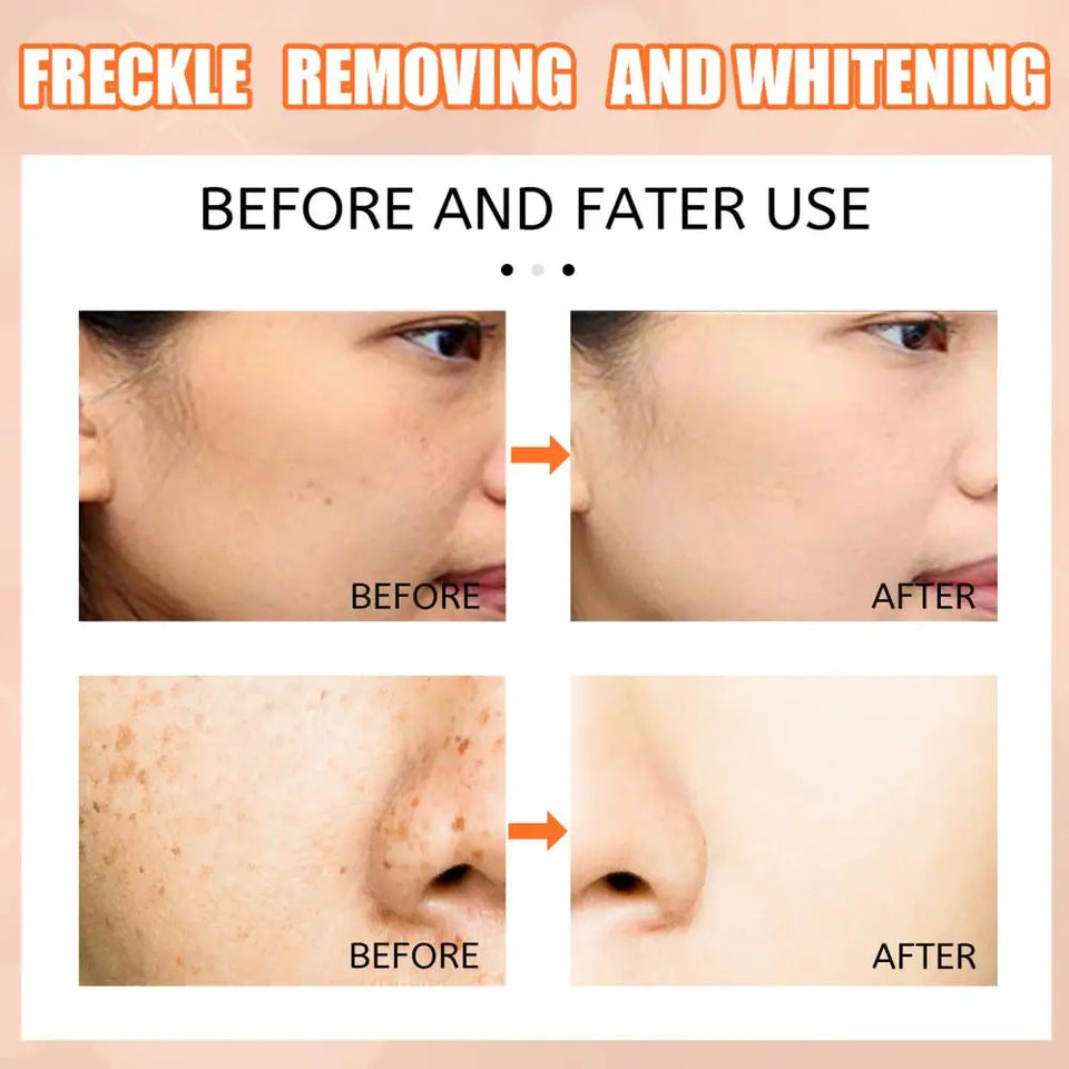 15ml  Skin Care Cream Functional Vitamin C Brightening Face Cream Compact Face Cream  Freckle Removal Cream Pen for Female