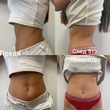 Nova Neo RF HIEMT EMS Body Sculpting Machine Muscle Building Stimulation Fat Burning Weight Loss Device for Fitness And Wellness