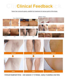 2025 Newest 808nm Diode ICE Platinum Diode Hair Removal Machine 755 808 1064nm hair remove hair
