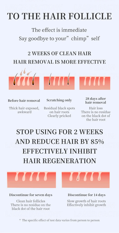 Professional 4-wave diode laser hair removal device, painless permanent hair removal device, laser hair removal device