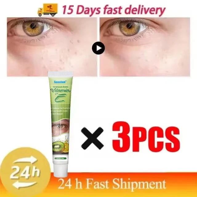 Fat Granules Remover Eye Cream Effective Remove Fat Granules Puffiness Anti-Particles Milia Remover Product Repair Eye Skin Care