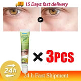 Fat Granules Remover Eye Cream Effective Remove Fat Granules Puffiness Anti-Particles Milia Remover Product Repair Eye Skin Care