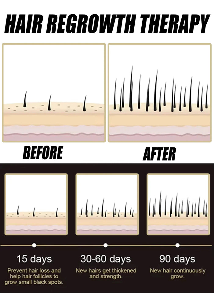 2026  latest technology new products Anti-hair Loss Essence Promotes Hair Growth and Improves The Scalp Environment