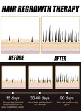 2026  latest technology new products Anti-hair Loss Essence Promotes Hair Growth and Improves The Scalp Environment