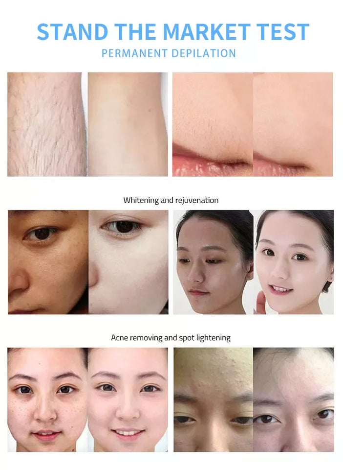 Factory direct sales M22 OPT IPL Diode Laser Hair Removal Device for Acne Skin Regeneration, Permanent Hair Removal and Whitenin