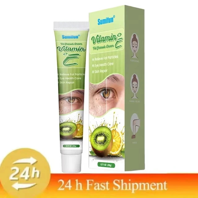 Fat Granules Remover Eye Cream Effective Remove Fat Granules Puffiness Anti-Particles Milia Remover Product Repair Eye Skin Care