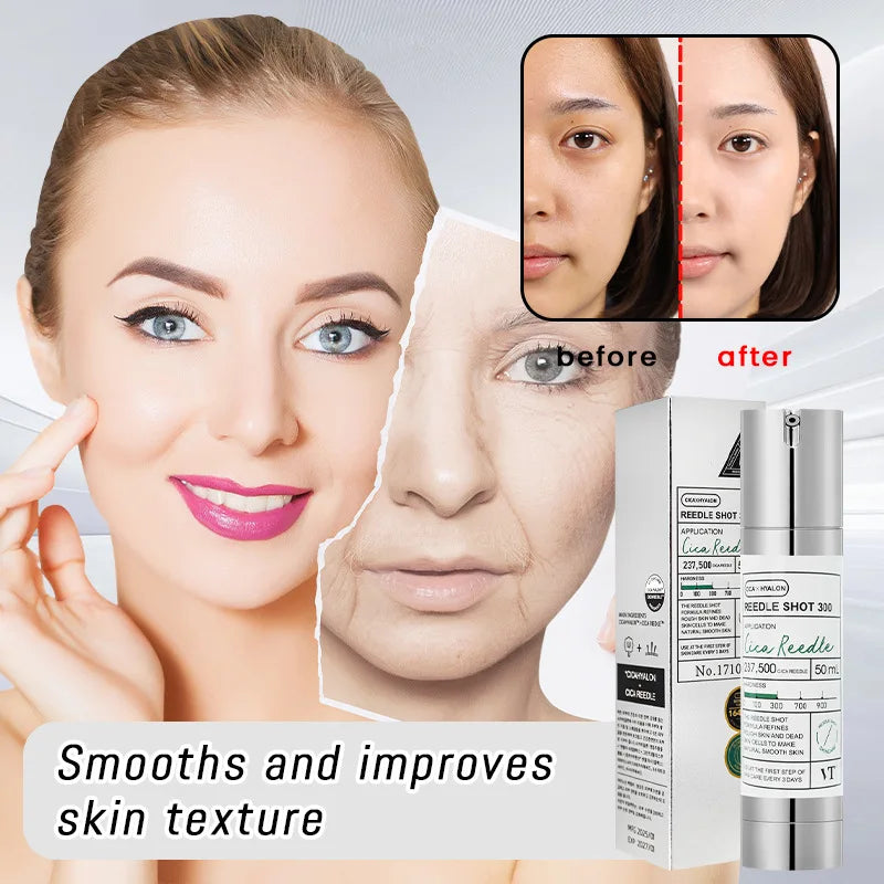 Korean Propolis Essence Facial Repair Brightening Microneedle 300/100 Essence Moisturizing Anti-Aging Fade Dark Spots Skin Care