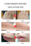 Professional 4-wave diode laser hair removal device, painless permanent hair removal device, laser hair removal device