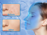 4 Colors Silicone LED Face Mask LED Red Light Photon Infrared Therapy Flexible Facial Mask Repair Skin Brighten Skin Tone