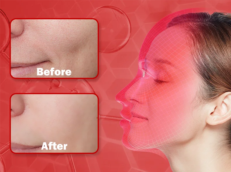 4 Colors Silicone LED Face Mask LED Red Light Photon Infrared Therapy Flexible Facial Mask Repair Skin Brighten Skin Tone
