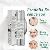 Korean Propolis Essence Facial Repair Brightening Microneedle 300/100 Essence Moisturizing Anti-Aging Fade Dark Spots Skin Care