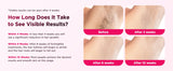 990000 Flash Laser Epilator IPL Hair Removal For Men and Women Body Bikini Facial  Permanant Painless IPL Hair Remover Machine