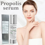 Korean Propolis Essence Facial Repair Brightening Microneedle 300/100 Essence Moisturizing Anti-Aging Fade Dark Spots Skin Care