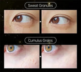Fat Granules Remover Eye Cream Effective Remove Fat Granules Puffiness Anti-Particles Milia Remover Product Repair Eye Skin Care