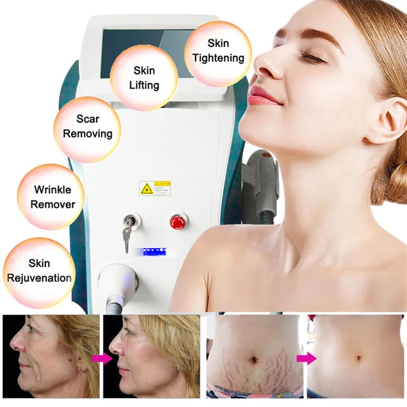 Factory direct sales M22 OPT IPL Diode Laser Hair Removal Device for Acne Skin Regeneration, Permanent Hair Removal and Whitenin