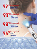 2025 New Upgrade Blue Laser Solve Wart Tool