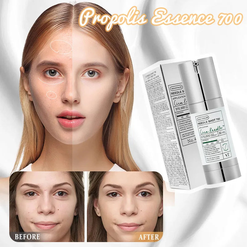 Korean Propolis Essence Facial Repair Brightening Microneedle 300/100 Essence Moisturizing Anti-Aging Fade Dark Spots Skin Care